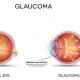 Eye Specialist in Zirakpur